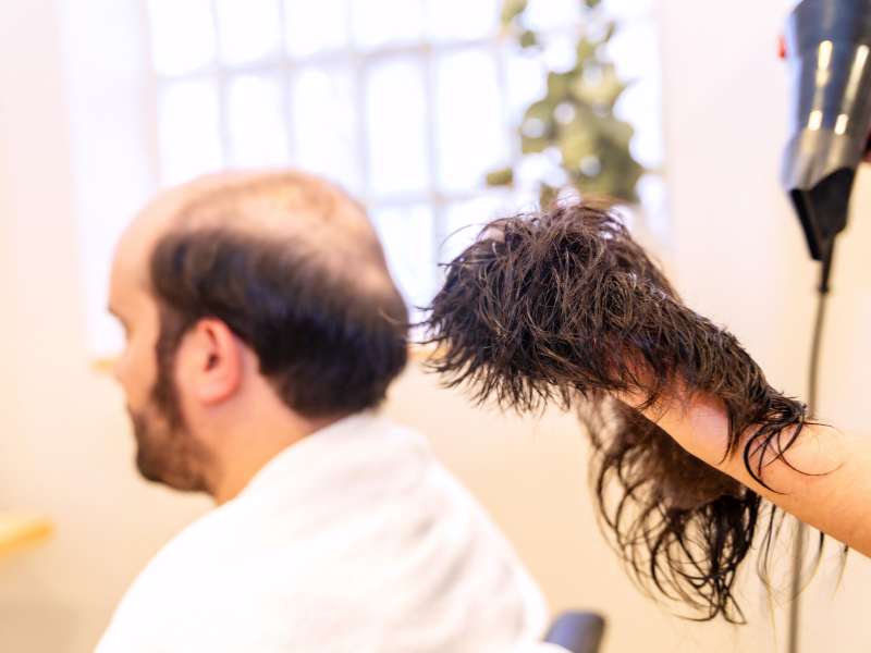 Custom Hair Topper for Men A Solution to Baldness