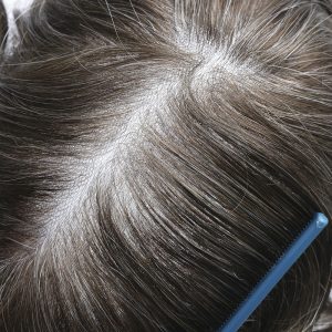 toupee vloop skin vs. traditional materials: a comparison